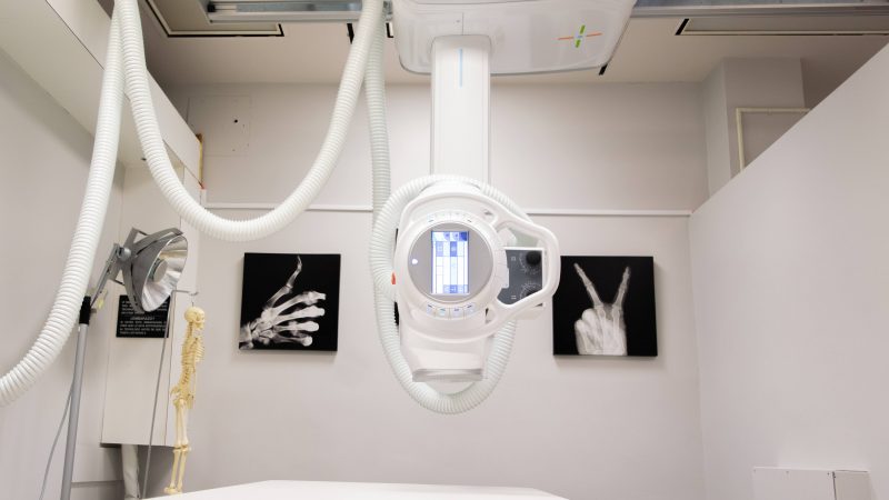 X ray machine sits in front of photos of xray hands giving thumbs up and peace signs