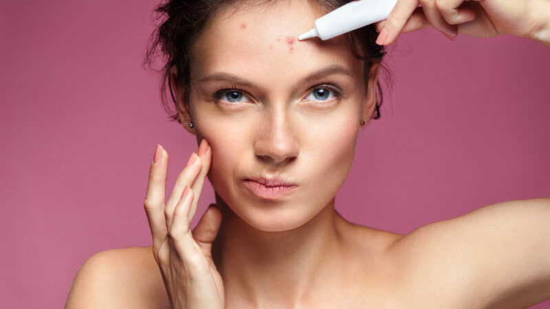 Person scowling and pointing at facial acne with white bottle